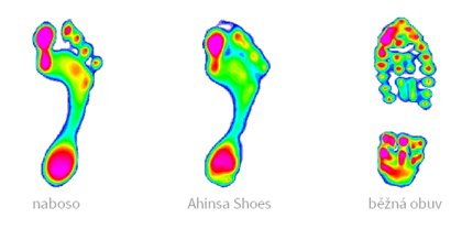 Fyzioterapie a barefoot obuv